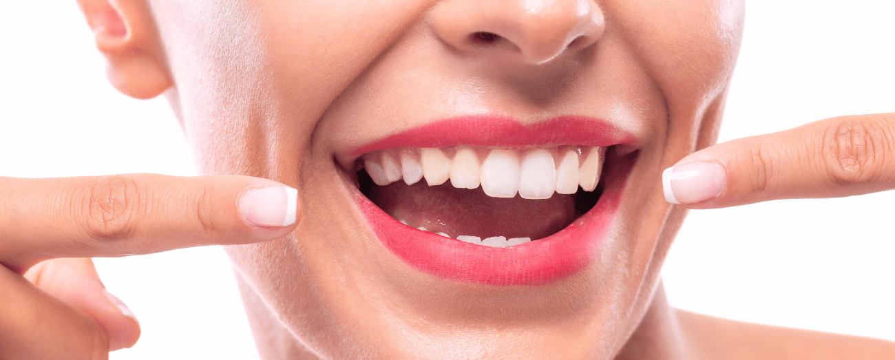 sbiancamento_dentale