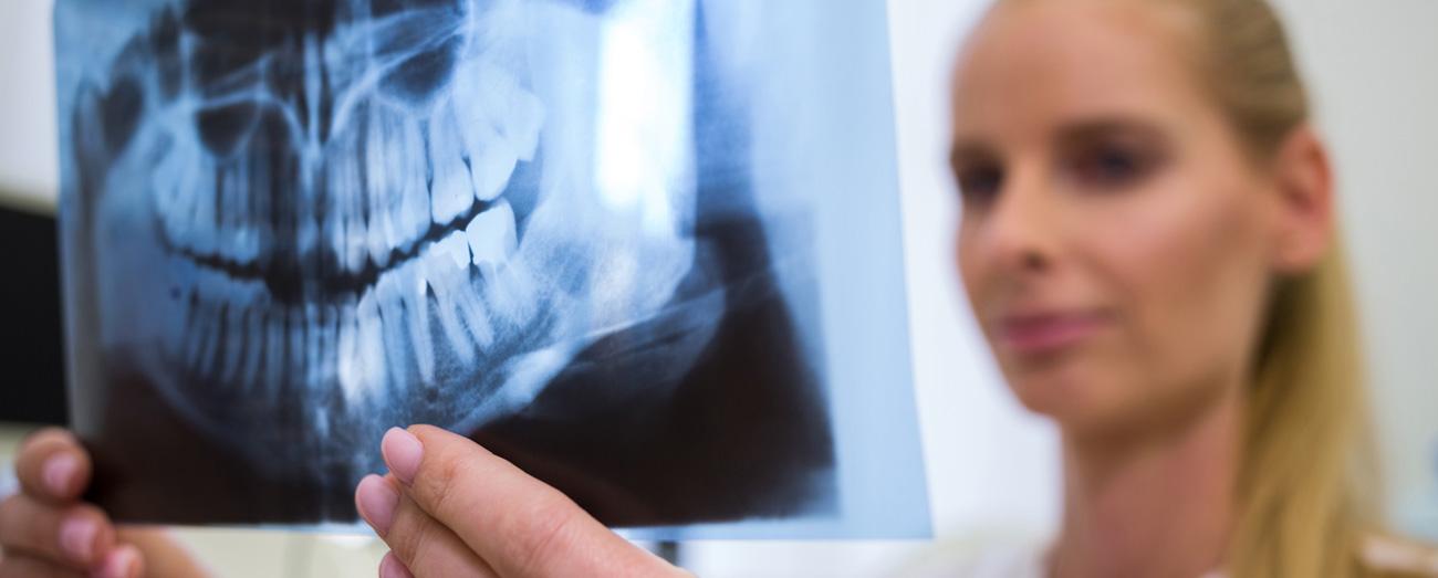 Radiografia Bitewing - Studio Dentistico Ferretti