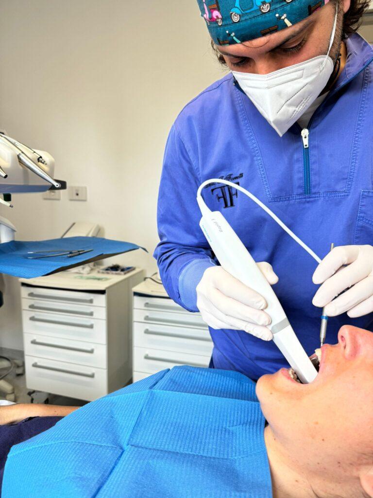 scanner intraorale digitale