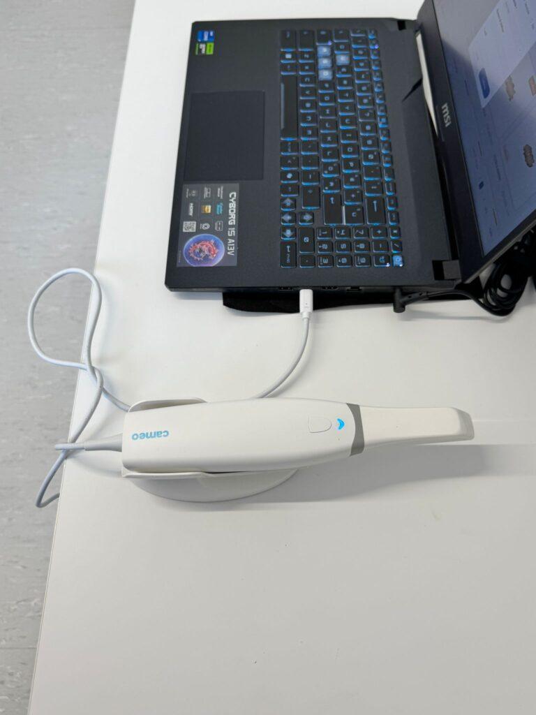 scanner intraorale digitale 1